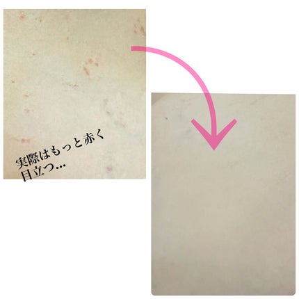 マーシュフィールド SC ボディカバーファンデN/マーシュ・フィールド/クリーム・エマルジョンファンデーションを使ったクチコミ(2枚目)