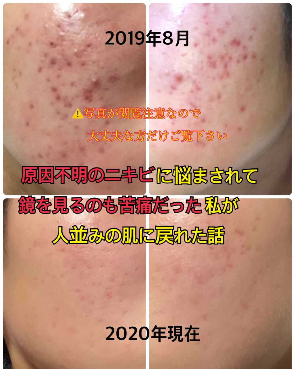 VC100エッセンスローション/ドクターシーラボⓇ/化粧水を使ったクチコミ(1枚目)