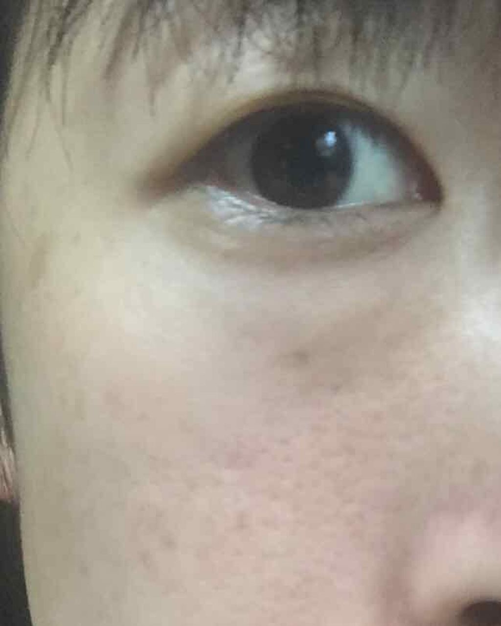 ダーマパワーX ステムリフトセラム/オバジ/美容液を使ったクチコミ（2枚目）