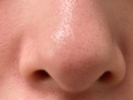 ホットクレンジングオイル/skinvill/オイルクレンジングを使ったクチコミ(2枚目)