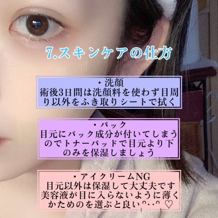 みる♡スキンケアオタク on LIPS 「二重埋没を考えている方、DT中の方は参考にしてください૮.̫...」(5枚目)