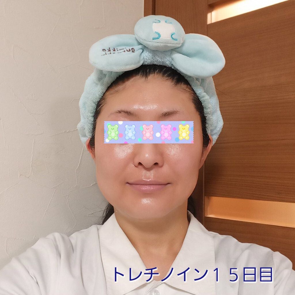 極潤α リフトクリーム/肌ラボ/フェイスクリームを使ったクチコミ(1枚目)