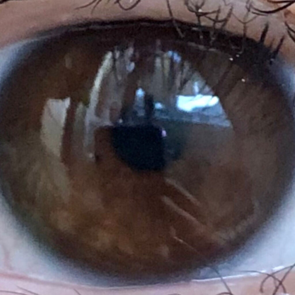 こうめ on LIPS 「私が瞳の色素を薄くした方法を書いていきたいと思います。上記の2..」(2枚目)