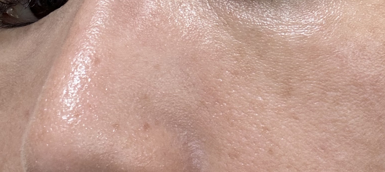 ディオールスキン フォーエヴァー スキン コレクト コンシーラー 1Nニュートラル/Dior/リキッドコンシーラーを使ったクチコミ（2枚目）