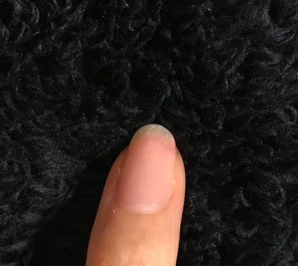 ピールオフベースコート/HOMEI/ネイルベースコートを使ったクチコミ(4枚目)