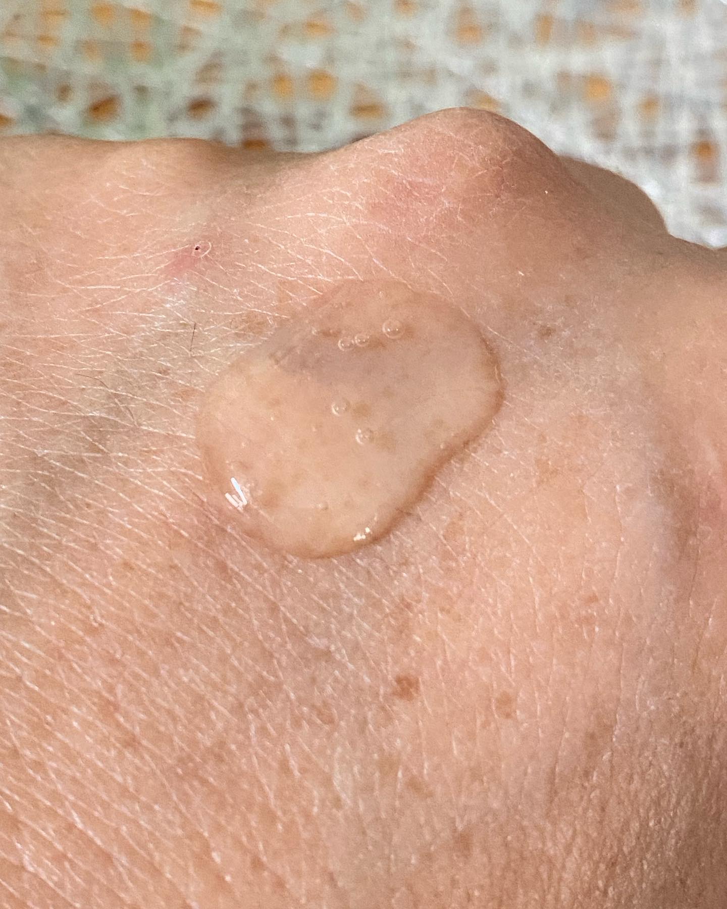 キレイ・デ・ボーテ セラムEX/キレイ・デ・ラボ/美容液を使ったクチコミ（3枚目）