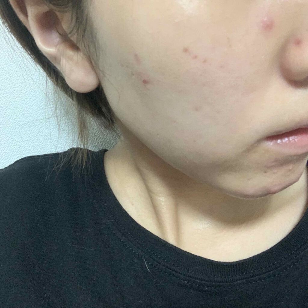 化粧水・敏感肌用・しっとりタイプ/無印良品/化粧水を使ったクチコミ（1枚目）