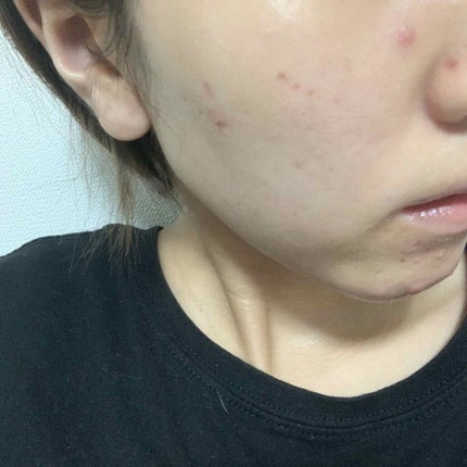 ロゼット洗顔パスタ 海泥スムース/ロゼット/洗顔フォームを使ったクチコミ(1枚目)