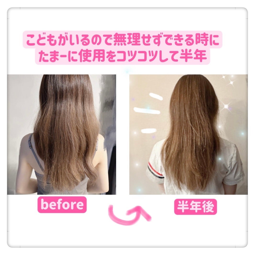 超音波トリートメント シャインプロ/YA-MAN TOKYO JAPAN/その他ヘアアイロンを使ったクチコミ(6枚目)