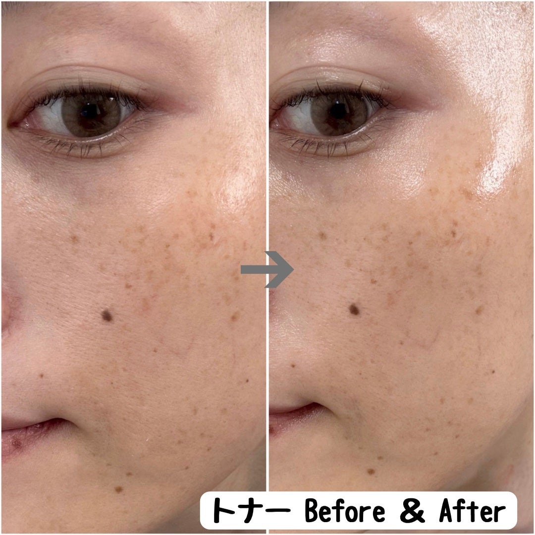 ヴィーガンリポソームレチノールセラム/SKIN&LAB/美容液を使ったクチコミ(5枚目)