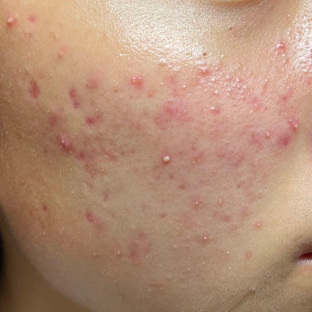 3番 すべすべキメケアセラム/numbuzin/美容液を使ったクチコミ(2枚目)