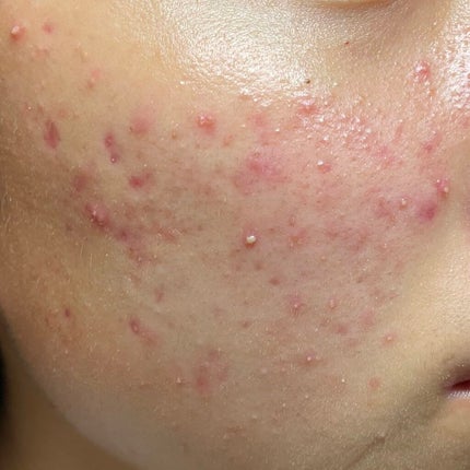 3番 すべすべキメケアセラム/numbuzin/美容液を使ったクチコミ(2枚目)