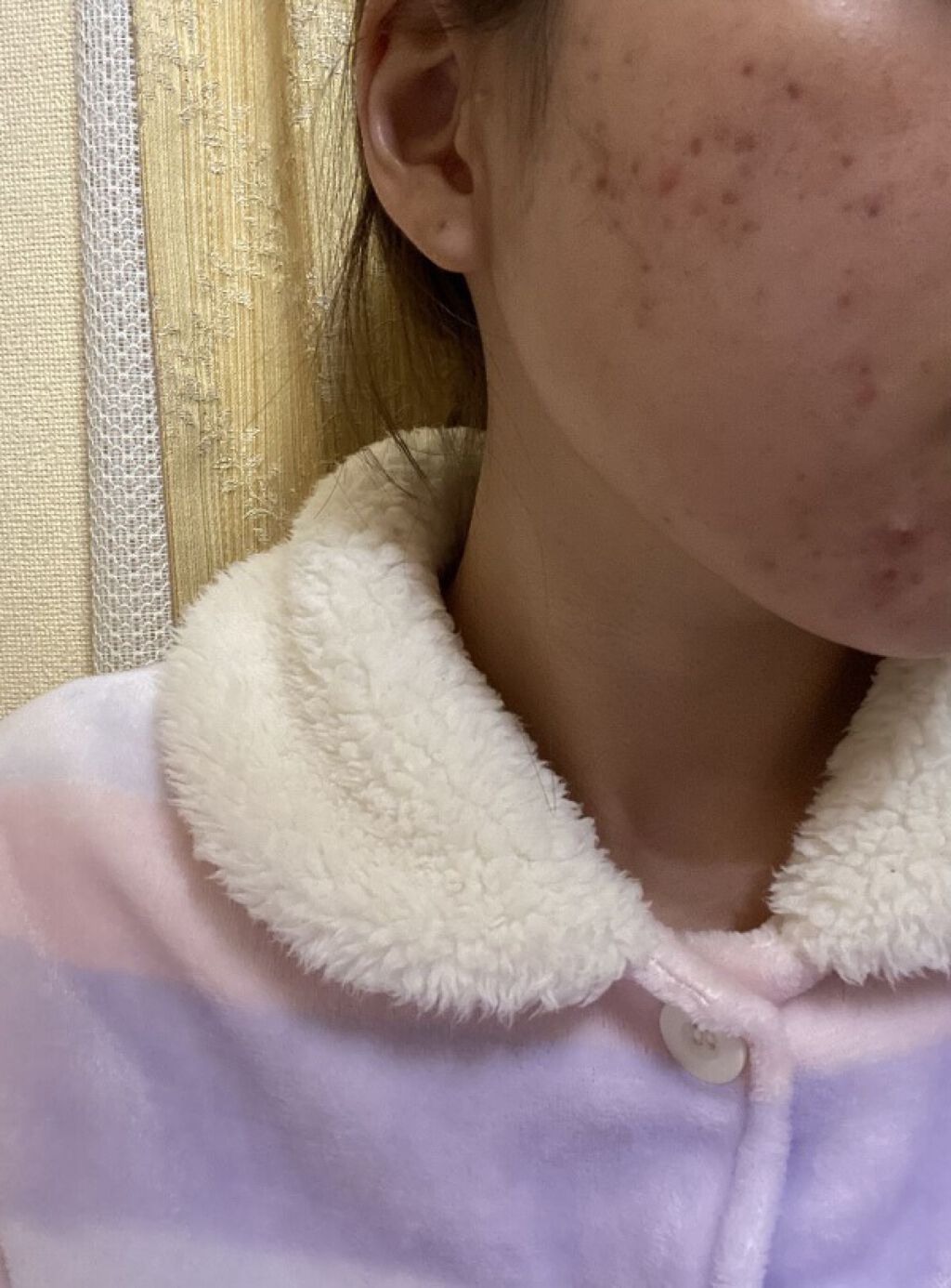 ホワイトニング エッセンス/アルージェ/美容液を使ったクチコミ（1枚目）