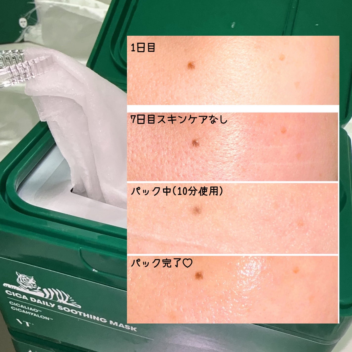 CICA デイリースージングマスク/VT/シートマスク・パックを使ったクチコミ(3枚目)