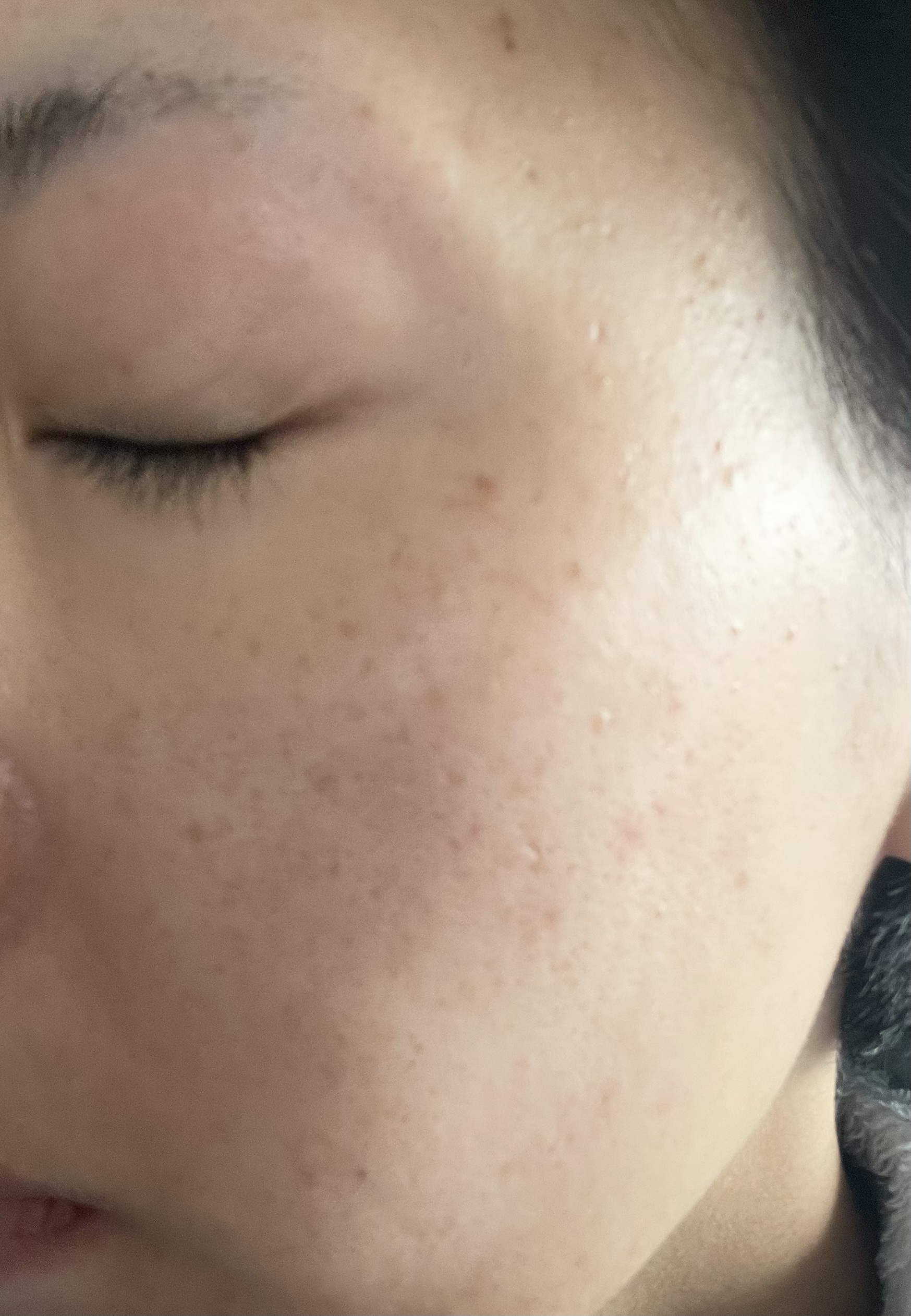 ツボクサ化粧水/ONE THING/化粧水を使ったクチコミ（2枚目）