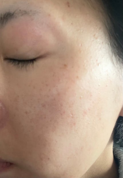 ツボクサ化粧水/ONE THING/化粧水を使ったクチコミ(2枚目)