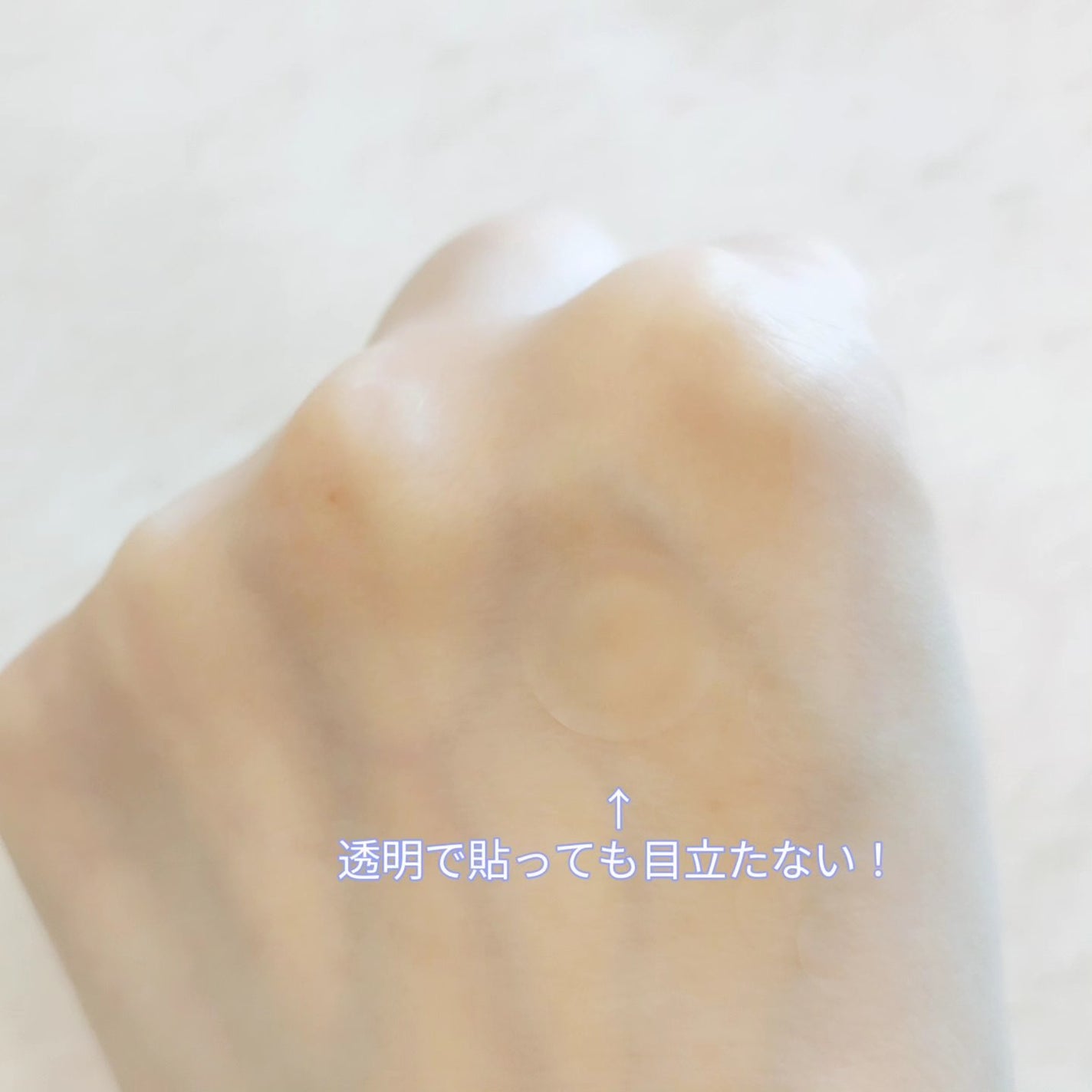 プロCICA クリアスポットパッチ/VT/その他スキンケアを使ったクチコミ(4枚目)