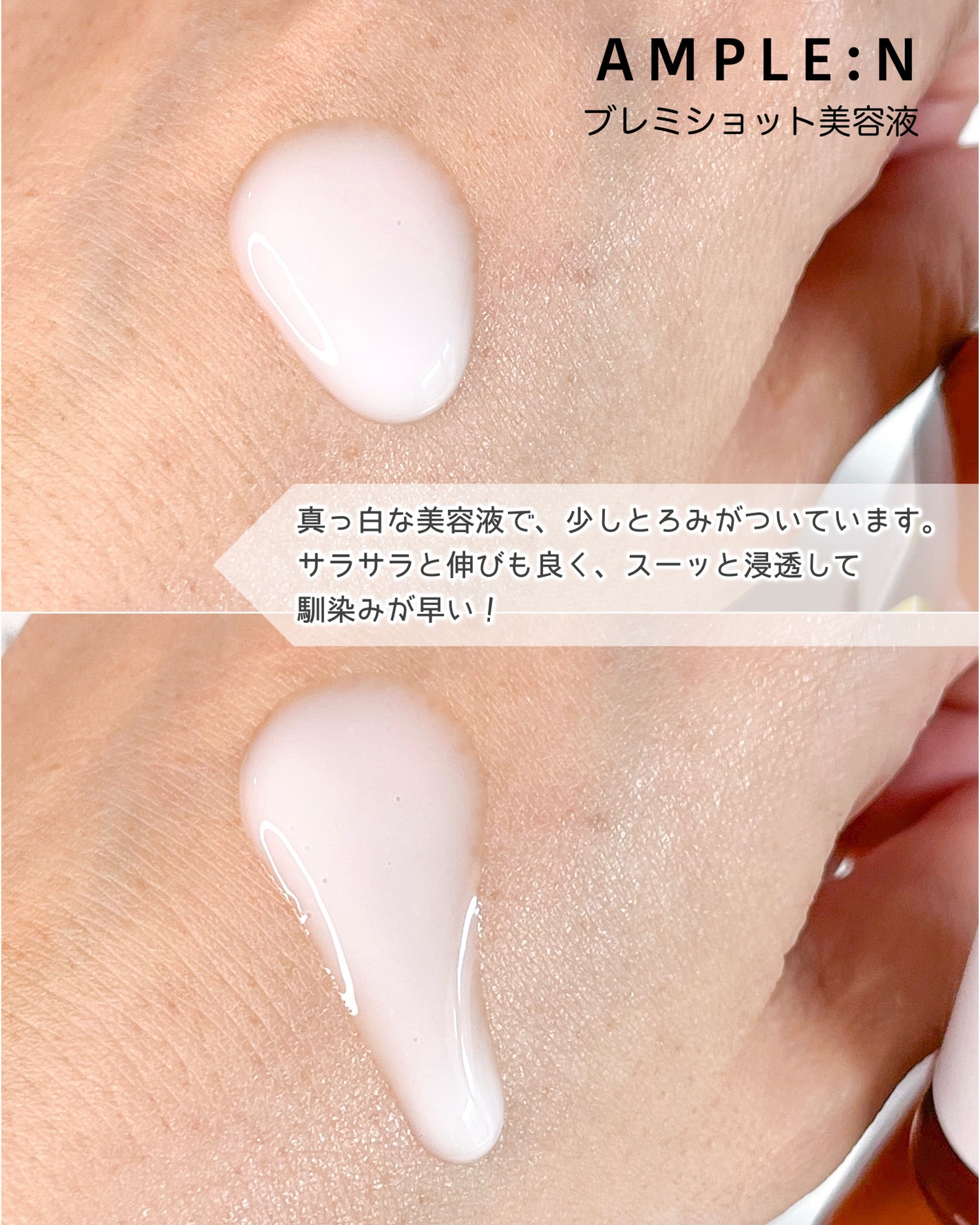 ブレミショット美容液/AMPLE:N/美容液を使ったクチコミ(3枚目)