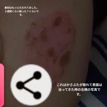 クレアラシル 薬用洗顔クリーム マイルドタイプのクチコミ「こんにちくわ！どうも！初投稿のKikiです‼️( ｰ̀∀ｰ́ )

今回はわたしの初投稿は残念.....」（2枚目）