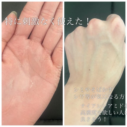 RXザ・ナイアシンアミド15セラム /COSRX/美容液を使ったクチコミ(2枚目)