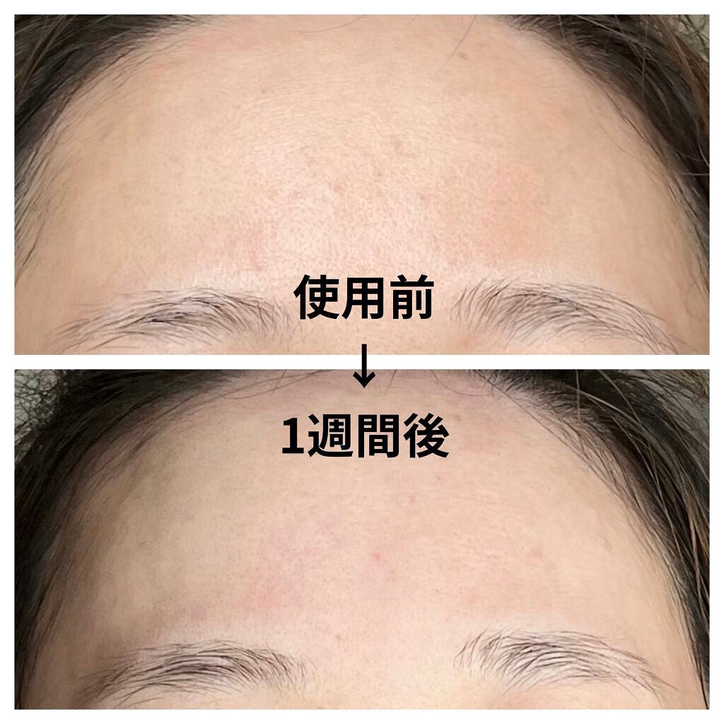 ドクダミ 77 スージングトナー/Anua/化粧水を使ったクチコミ(3枚目)