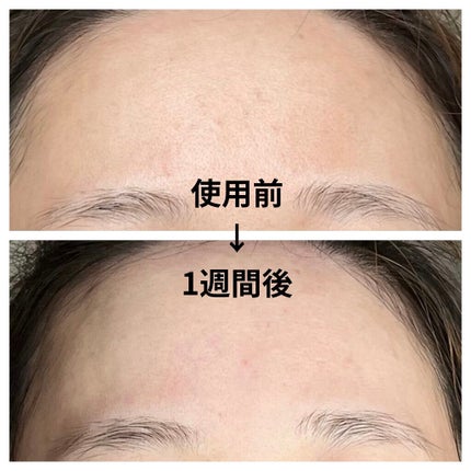 ドクダミ 77 スージングトナー/Anua/化粧水を使ったクチコミ(3枚目)