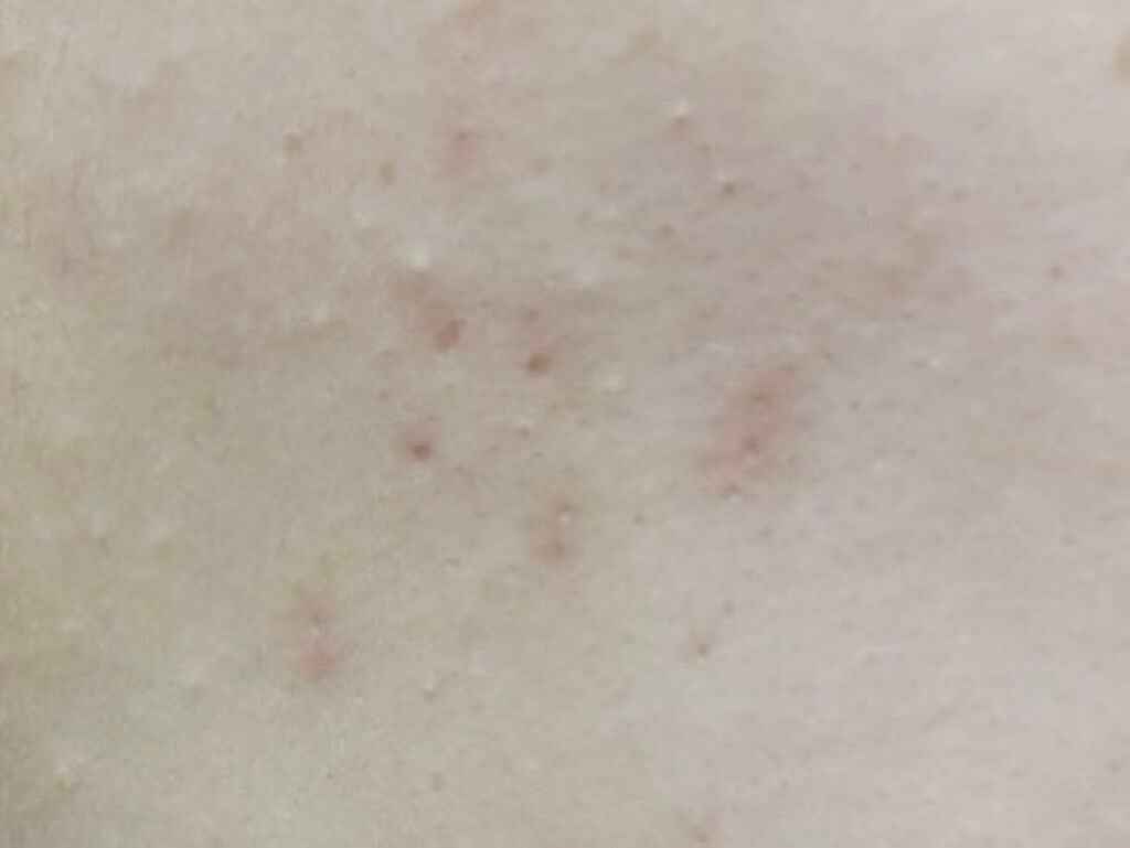 クリアフル ウォッシュ/オルビス/洗顔フォームを使ったクチコミ(6枚目)