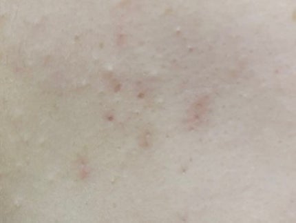 クリアフル ウォッシュ/オルビス/洗顔フォームを使ったクチコミ(6枚目)