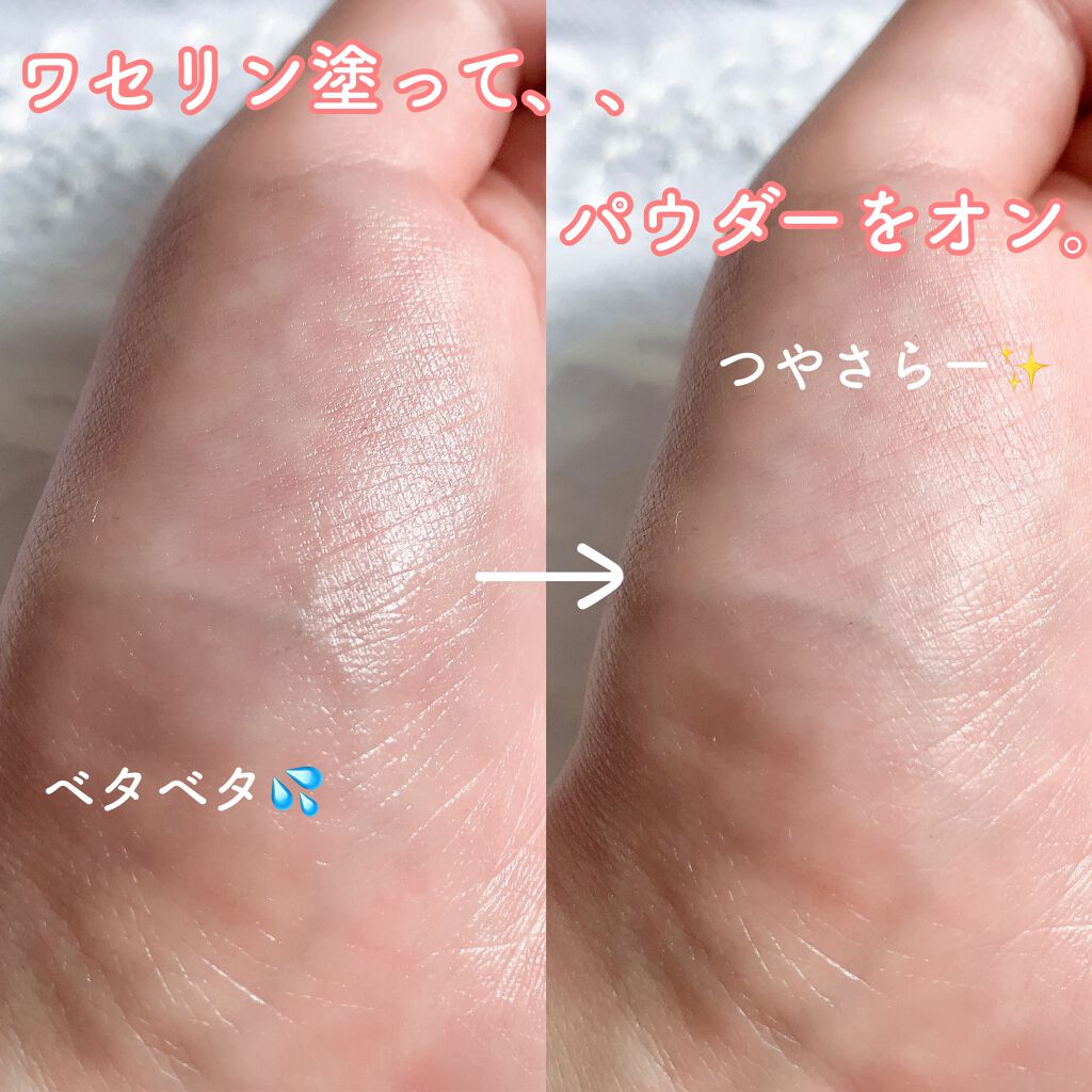 オリジナル ピュアスキンジェリー/ヴァセリン/ボディクリームを使ったクチコミ(4枚目)