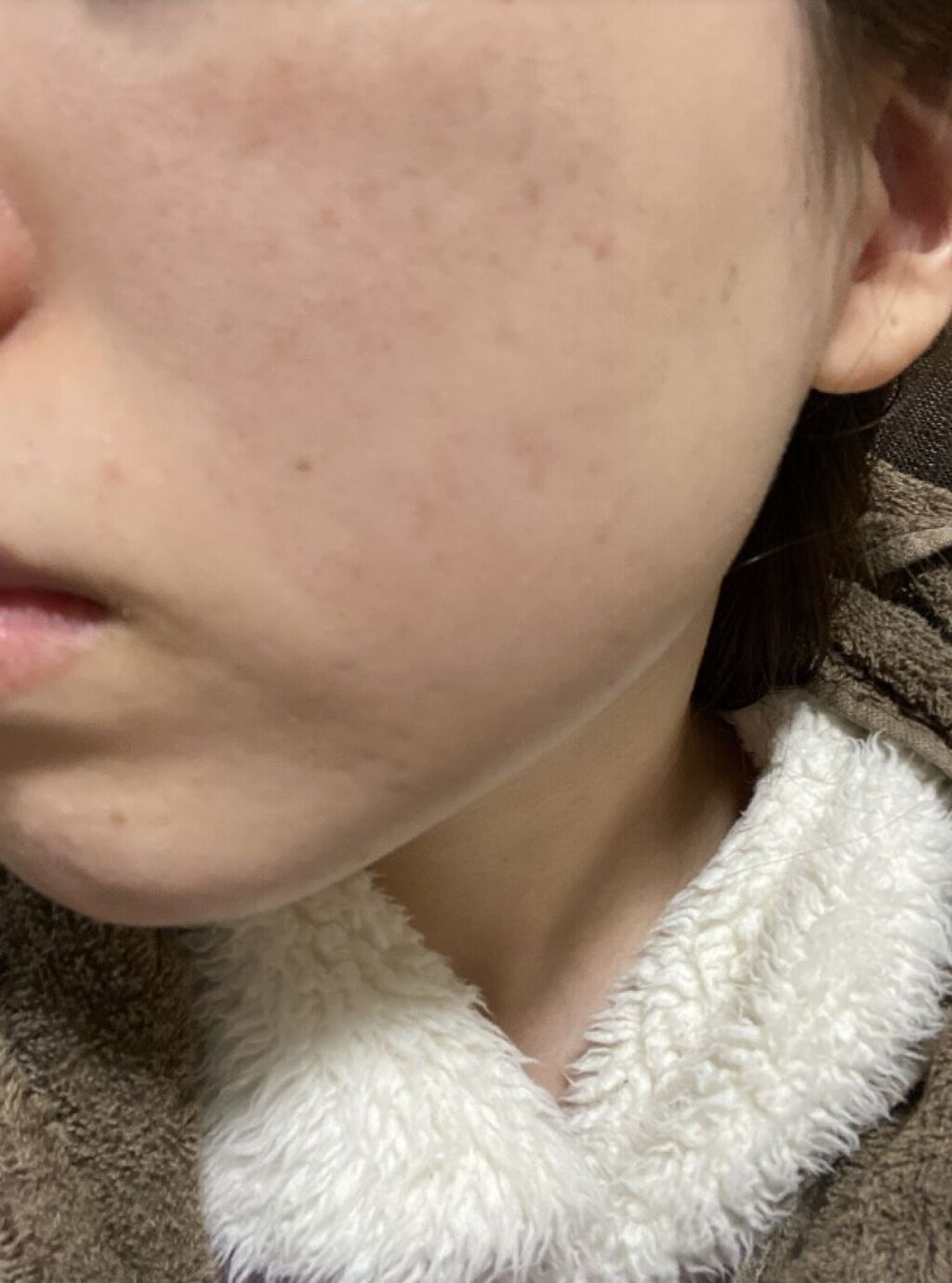 アピットジェル/全薬工業/美容液を使ったクチコミ（3枚目）