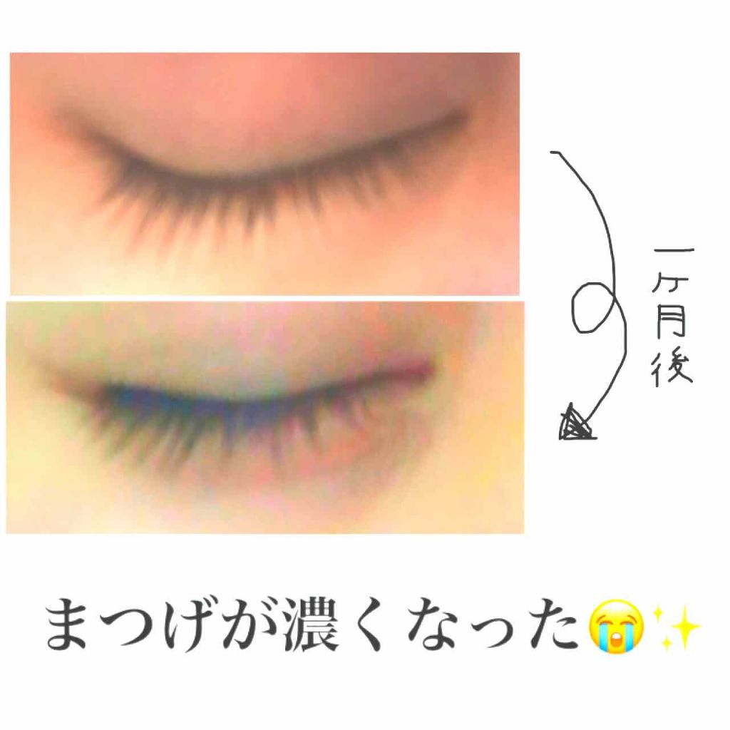 ビューティラッシュN/まつげ美容液を使ったクチコミ（1枚目）