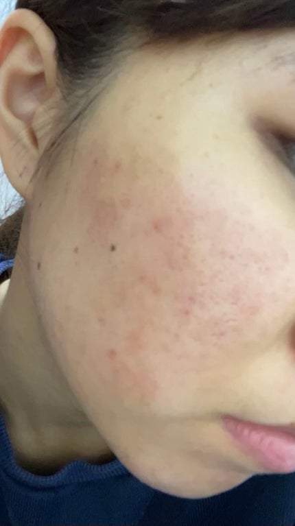 を使ったクチコミ(2枚目)