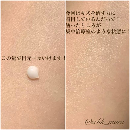 リンクルショット メディカル セラム/リンクルショット/アイケア・アイクリームを使ったクチコミ(5枚目)