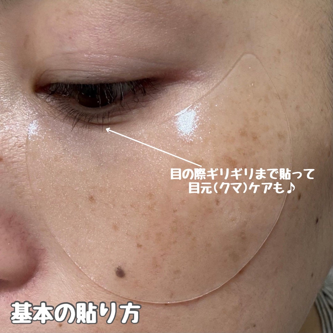 グルタチオンダークゼロトーニングパッチ/SNP/アイケア・アイクリームを使ったクチコミ(6枚目)