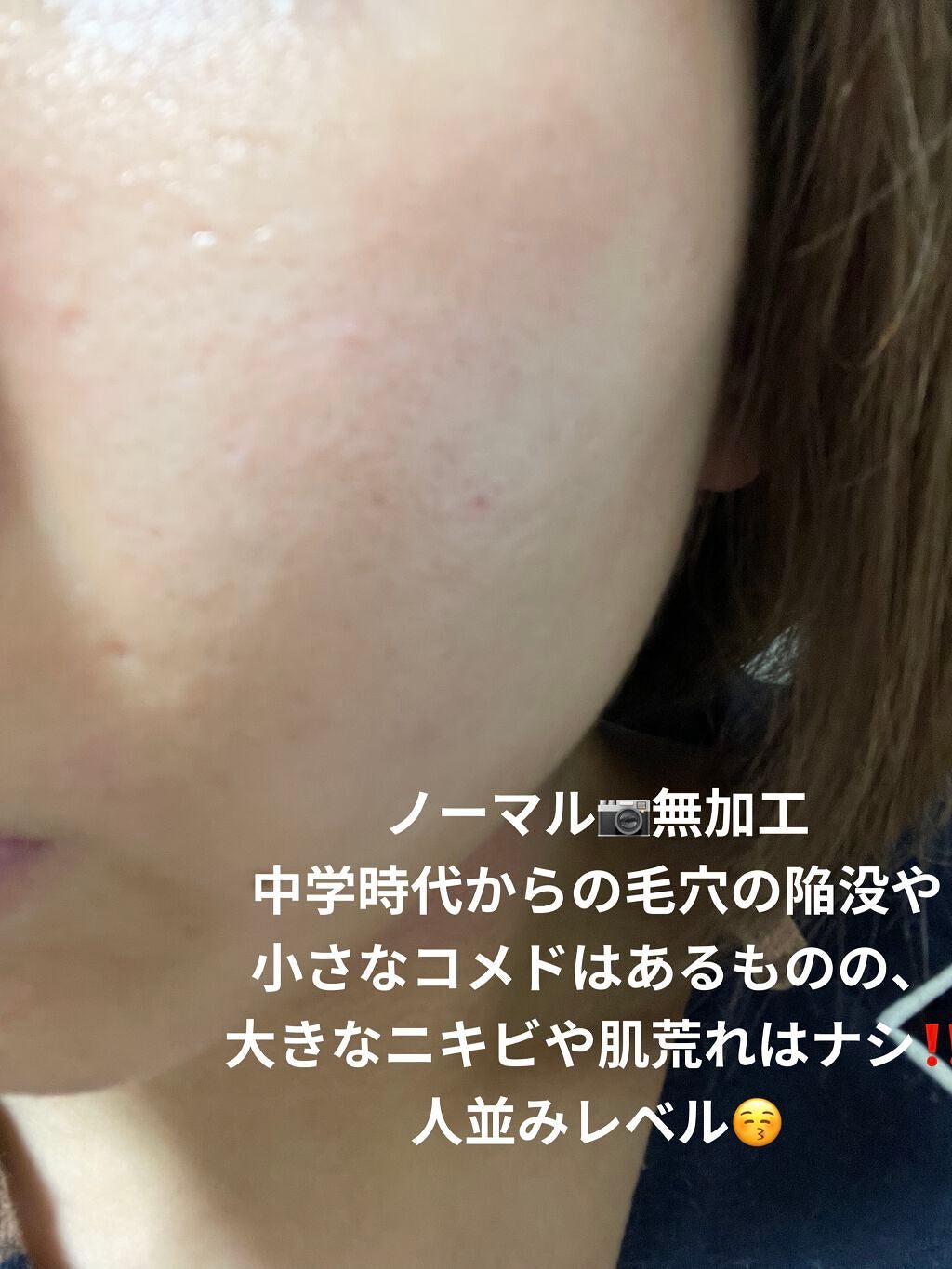 フルフィットプロポリスライトアンプル/COSRX/美容液を使ったクチコミ(3枚目)