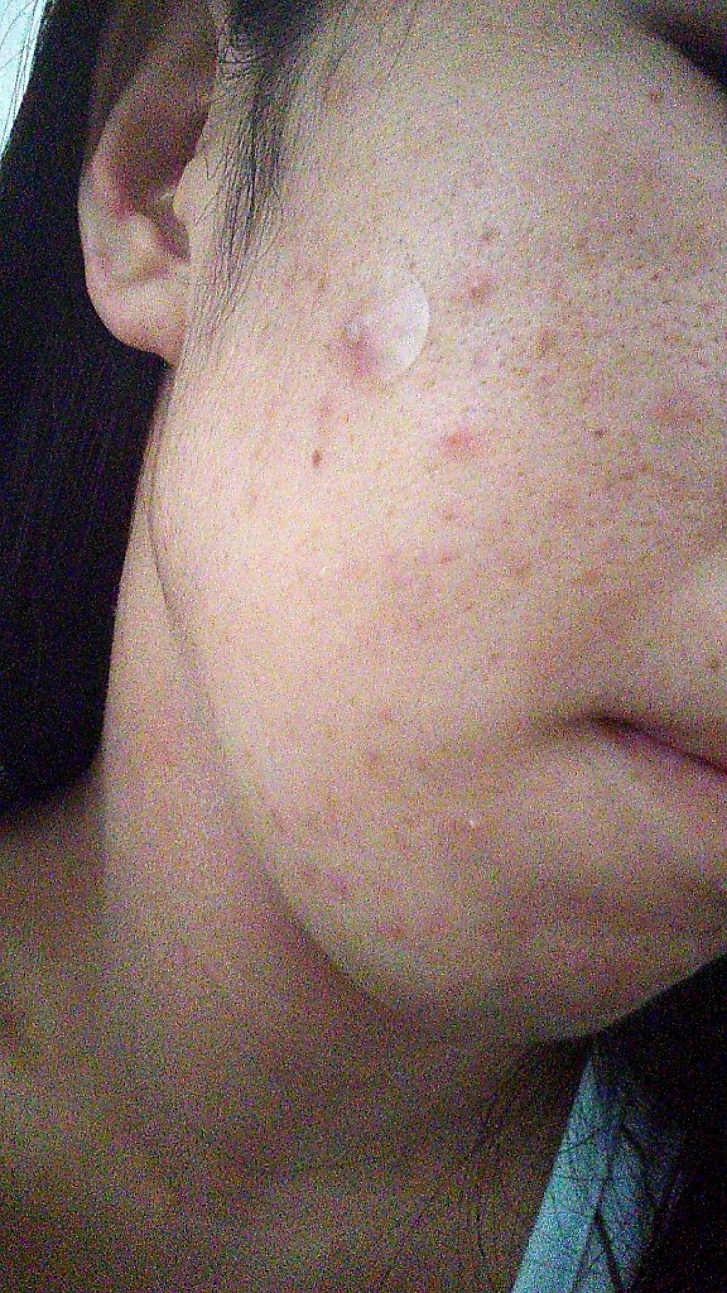 ACC パッチ/ETUDE/シートマスク・パックを使ったクチコミ(3枚目)