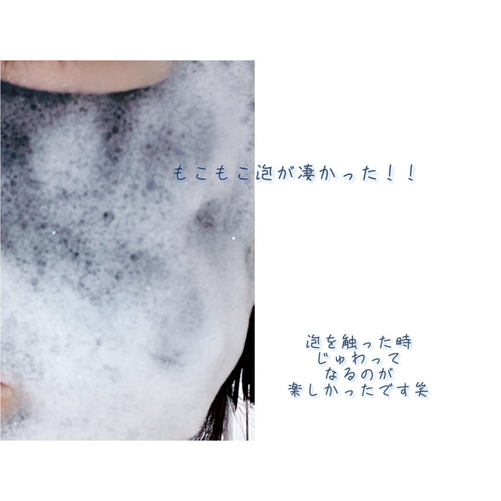 BLACK O2 泡パックVOlcanic/PUREDERM/シートマスク・パックを使ったクチコミ(2枚目)