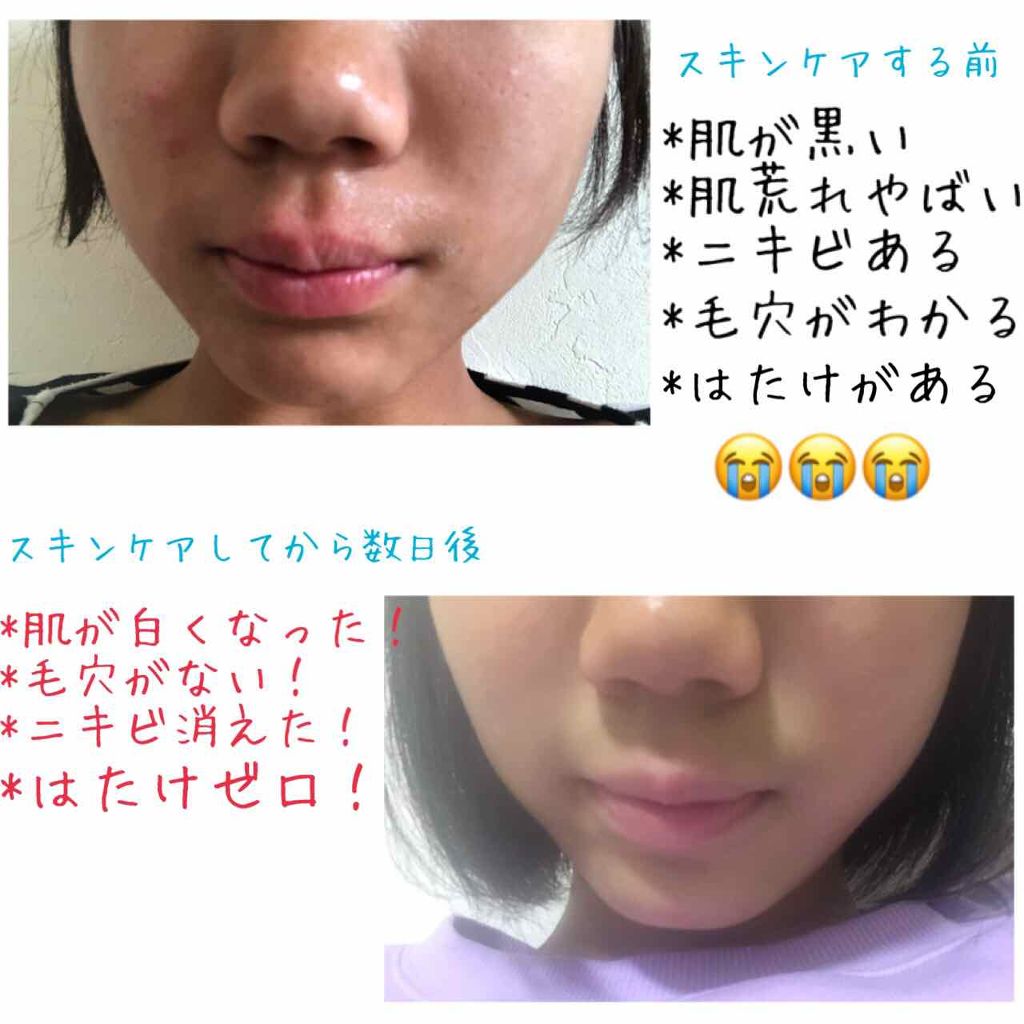 ハトムギ化粧水(ナチュリエ スキンコンディショナー R )/ナチュリエ/化粧水を使ったクチコミ(2枚目)