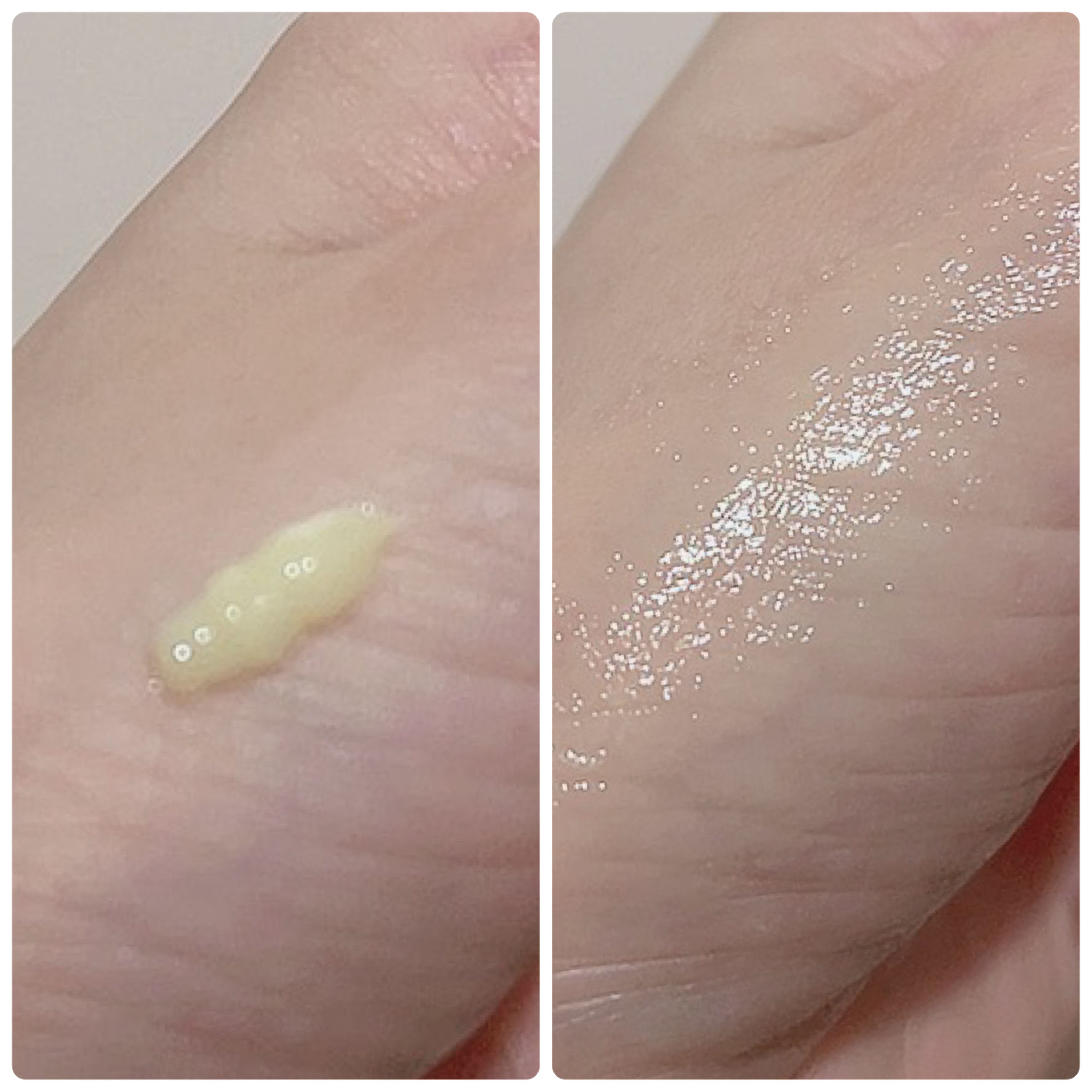 VITALIFT A forte/Dr.Different/フェイスクリームを使ったクチコミ（3枚目）