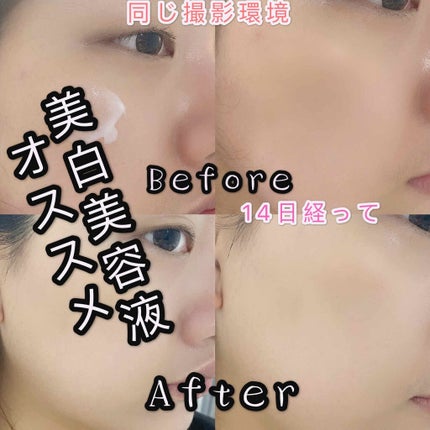 純白専科 すっぴん白雪美容液(専科 薬用美白クリーム)/SENKA(専科)/美容液を使ったクチコミ(1枚目)