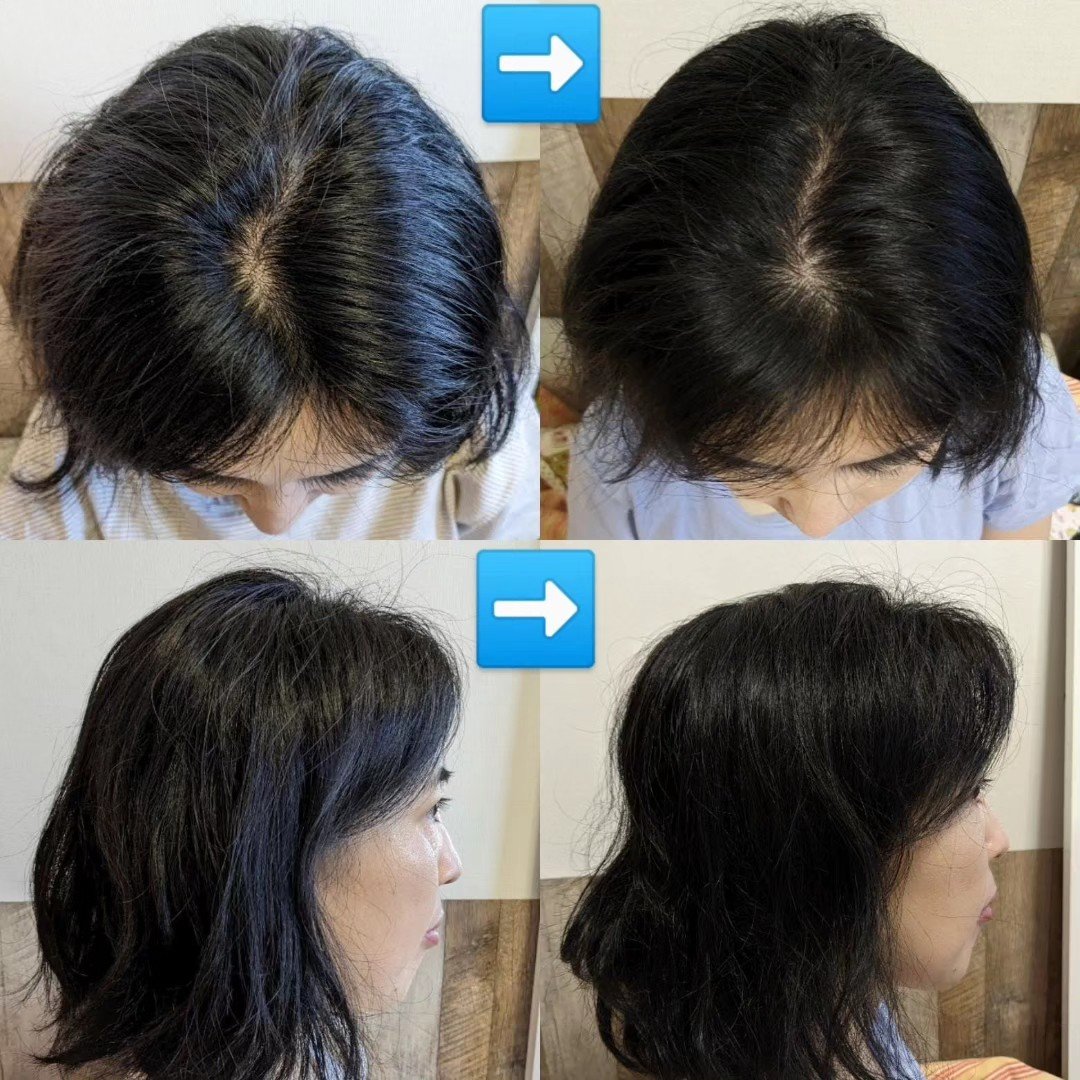 ふわ姫＜医薬部外品＞/ソーシャルテック/頭皮ローションを使ったクチコミ（1枚目）