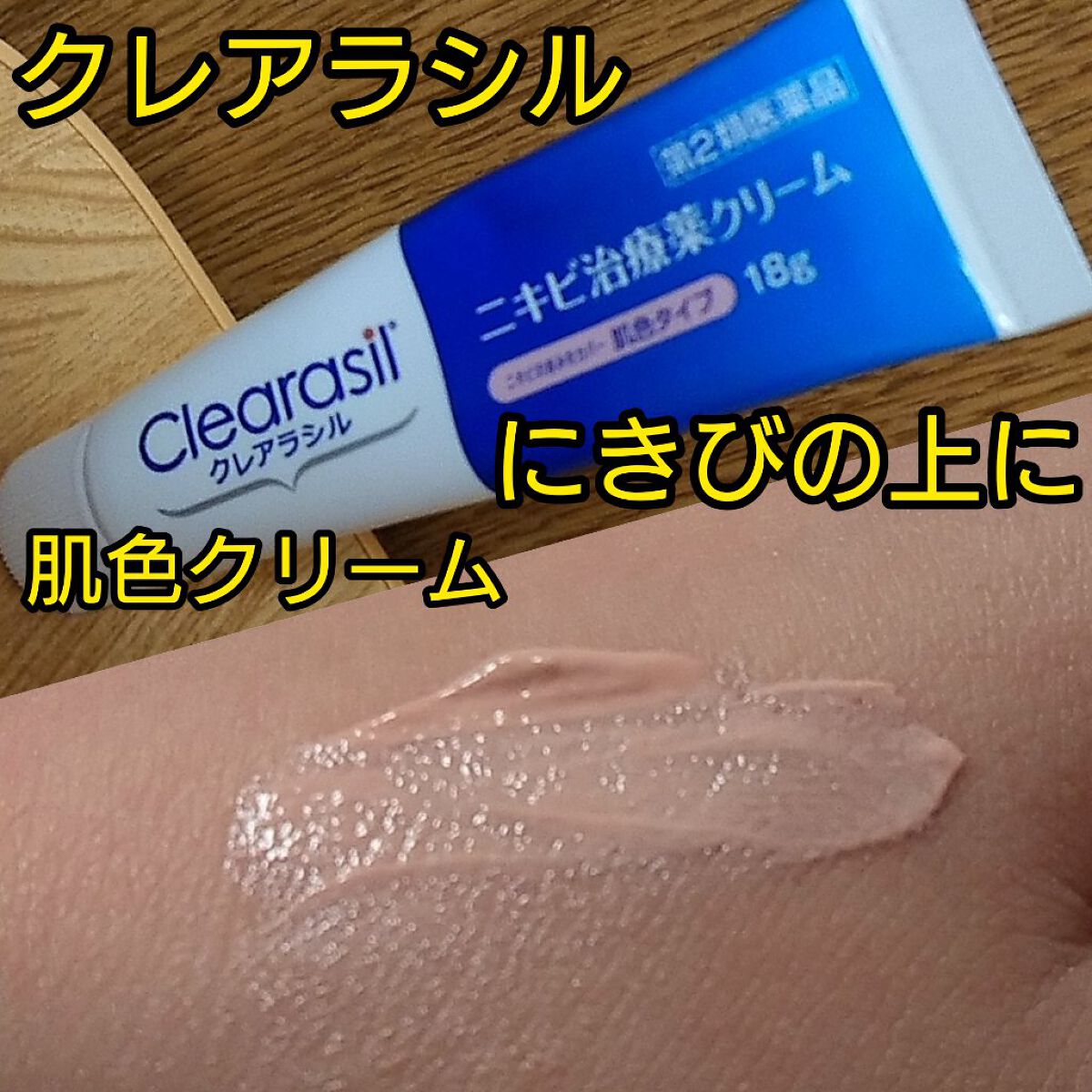 ニキビ治療薬クリーム (医薬品)/クレアラシル/その他を使ったクチコミ(1枚目)