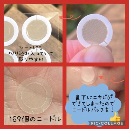 エーキュアショットスポットパッチ/obsero/にきびパッチを使ったクチコミ(2枚目)