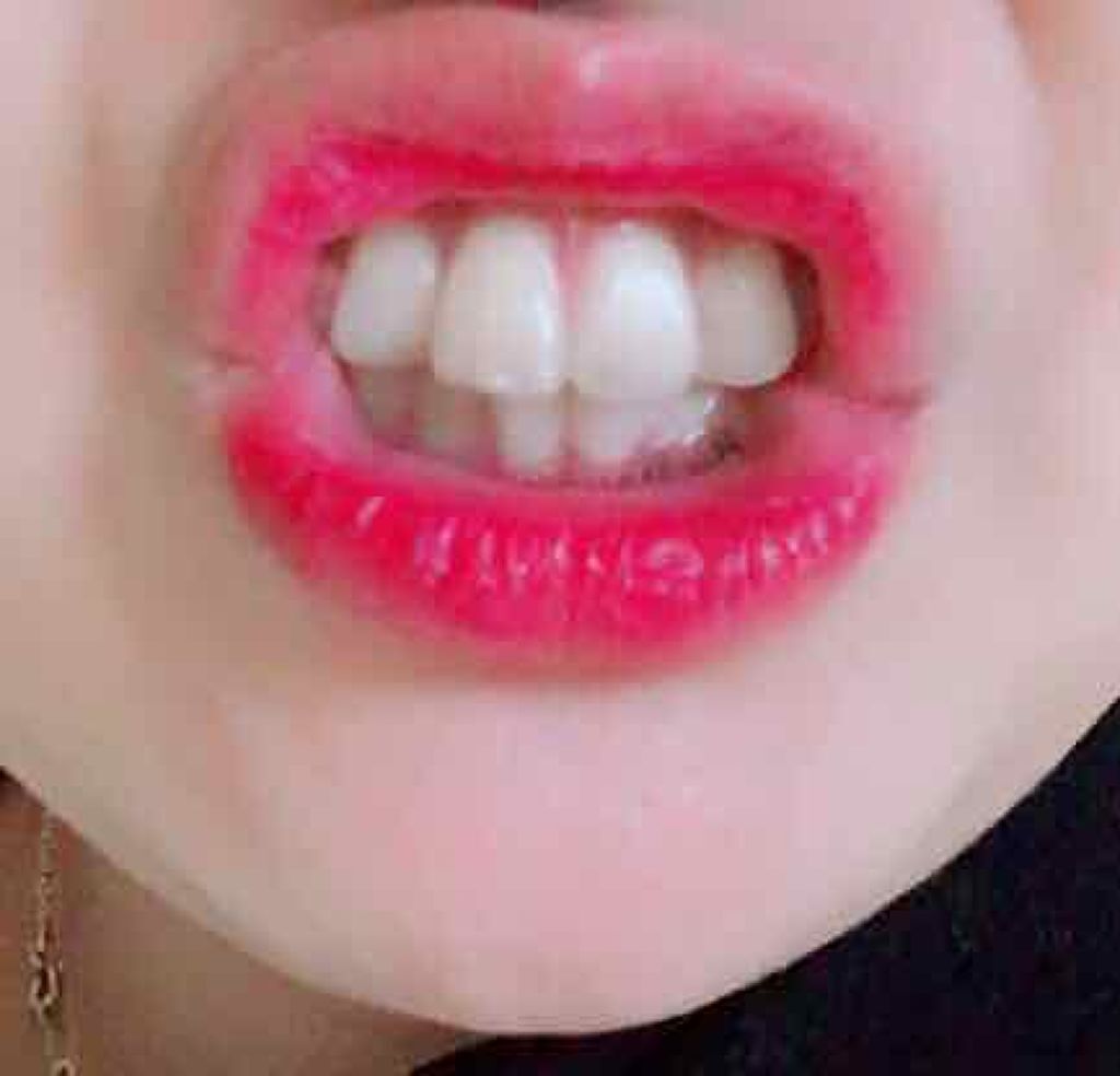 ジェリーリップティント/キャンドゥ/リップティントを使ったクチコミ(3枚目)