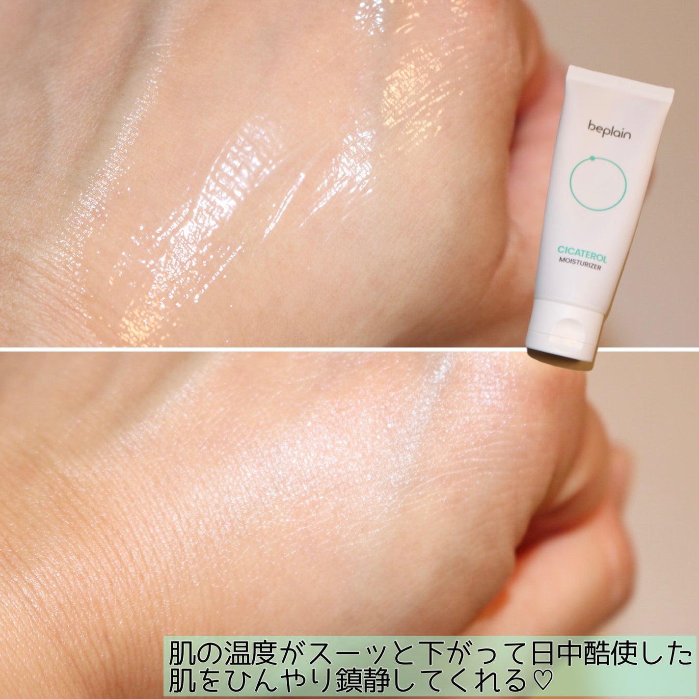 シカテロルクリーム/beplain/フェイスクリームを使ったクチコミ(4枚目)