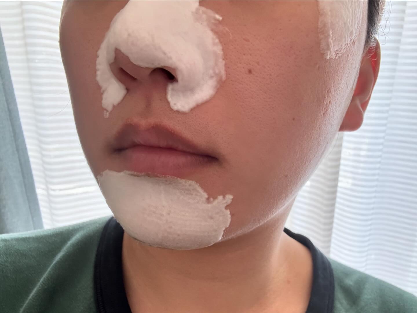 バイバイブラックヘッド グリーンティートックスバブルクレンザー/SOME BY MI/スクラブ・ゴマージュを使ったクチコミ（3枚目）