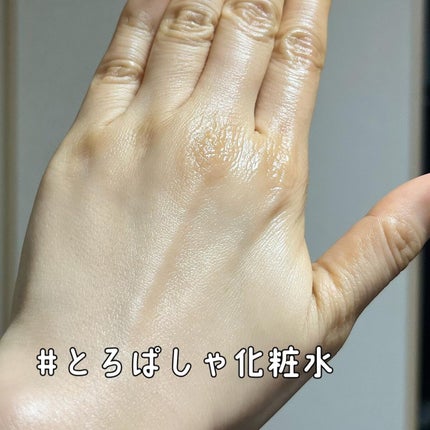 オルビスユー エッセンスローション /オルビス/化粧水を使ったクチコミ(4枚目)