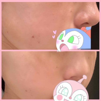 【旧品】マシュマロフィニッシュパウダー/キャンメイク/プレストパウダーを使ったクチコミ(2枚目)