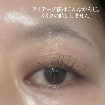 メジカルファイバー2/Automatic Beauty/二重まぶた用アイテムを使ったクチコミ(3枚目)