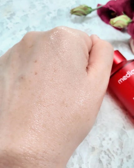 レッドアクネピーリングセラム/MEDICUBE/美容液を使ったクチコミ(7枚目)